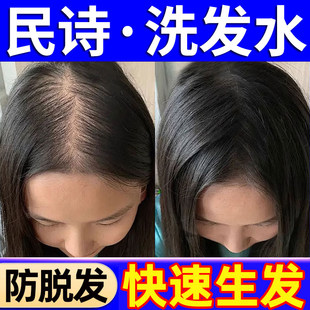 民诗洗发水防脱育发控油蓬松去屑止痒国货名诗明诗正品官方店