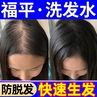 福萍洗发水防脱发生发控油蓬松去屑止痒福萍山姆正品官方店