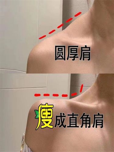 买1送1美肩神器 远离肉厚肩膀 不要溜肩滑肩 轻松拥有女神直角肩