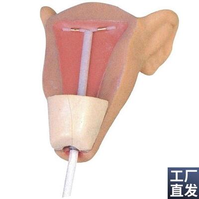 高级宫内避孕训练模型妇科y计划生育教学模型计生避孕模型