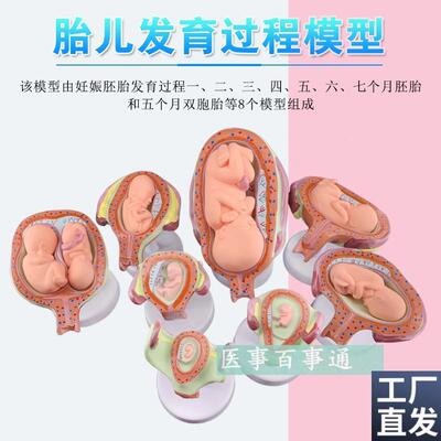 妊娠发育过程h模型胚胎计划生育模型计生展示模型胎儿模型子宫