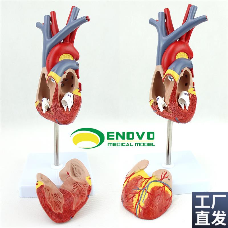 ENOVO颐诺人体心脏模型医学心血管内科心脏介R入解剖教学冠状动脉