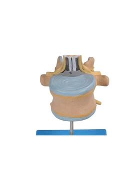 腰椎附脊髓与马尾神经放大模型GD/A18107