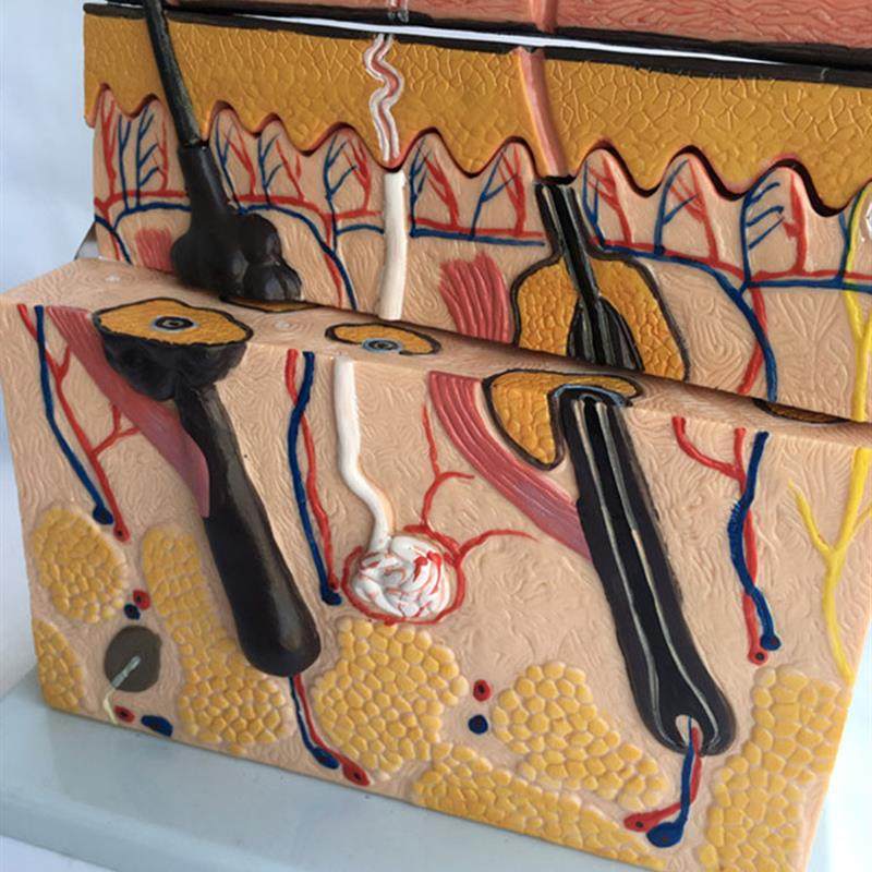 人体皮肤构造解剖模型病态表皮解剖模型真皮表皮皮下组织