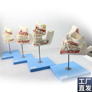 颐诺正品儿童牙列与颌骨发育模B型乳牙恒牙幼儿口腔牙齿保健模型