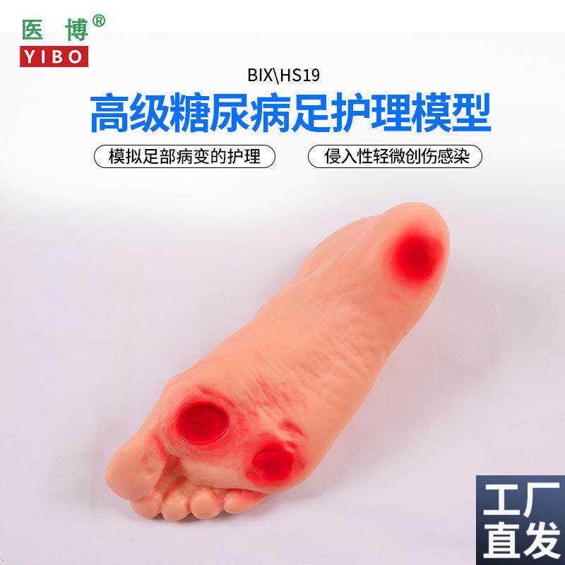 医博BIX-HS19高级糖尿病足部护理模型侵入性病变溃烂足部护.