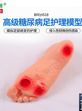 医博BIX-HS19高级糖尿病足部护理模型侵入性病变溃烂足部护.理训
