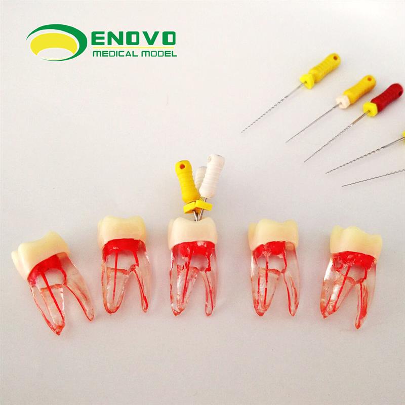 ENOVO正品根管仿真离体 RCT根管教学练习牙体牙髓根管器械操作
