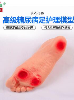 医博BIX-HS19高级糖尿病足部护理模型侵入性病变溃烂足部护D理训