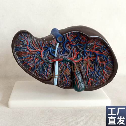 肝胆模型肝解f剖模型人体肝脏血管肝胆结构造胆囊胆管展示教学医
