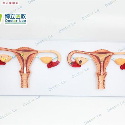 卵子受精过程放大模型女性卵子受精及卵j子发育输送及着床模型