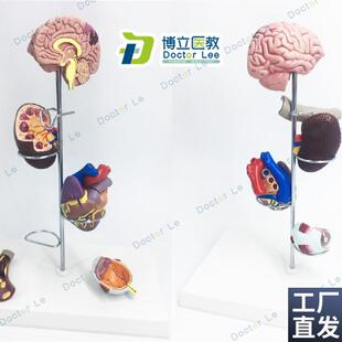 进口人体高血g压模型并发症心脏模型肾脏模型眼睛模型脑模型