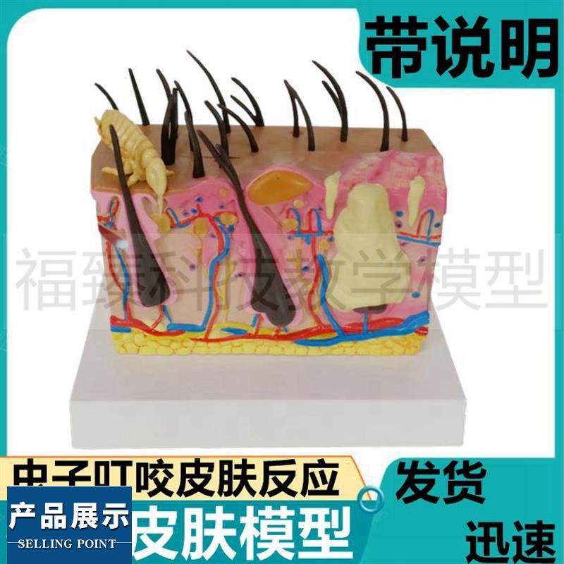 人体皮肤螨虫滋生模型蚊虫叮咬病理皮肤美容医用医药礼品皮下组织
