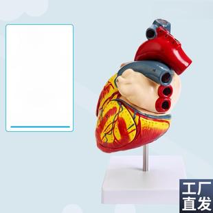 教学人工1:1人体心脏模型b超超声医学心脏病学天然V大心脏解剖模