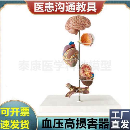 心脑血管a模型血液压力升高病理脏器受损糖尿眼底肾脏冠状动脉阻