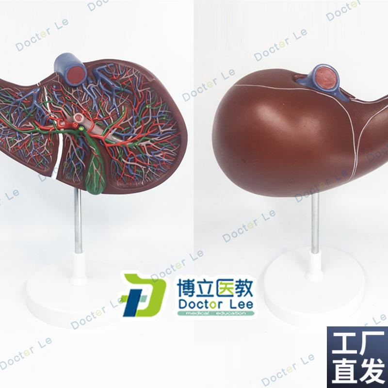 医学人体肝胆囊血管模型肝脏模型消化外N肝胆科消化系统带血管