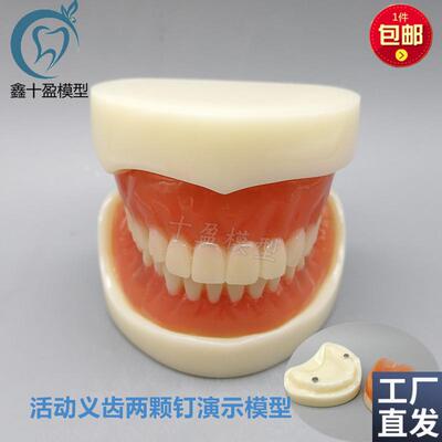牙科模型a活动义齿牙模讲解模型全口义齿两颗钉教学模型T21包邮