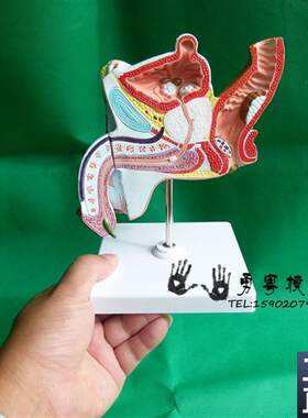 男性内生殖器病理模型病变生殖解剖模型男泌尿X系统疾病模型