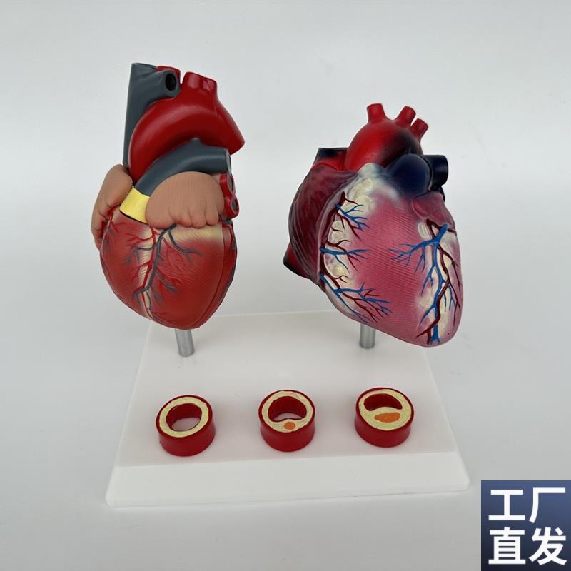 人体血管压高病理解剖心脏与内脏健F康心脏血管构造对比教学模具