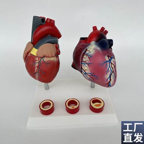 人体血管压高病理解剖心脏与内脏健F康心脏血管构造对比教学模具