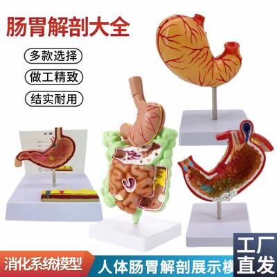 人体大肠病理h模型肠胃解剖模型大肠盲肠直肠十二指肠模型