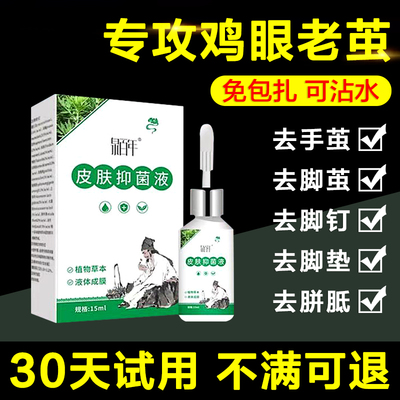 老茧去除软化剂去脚趾头茧子根膏