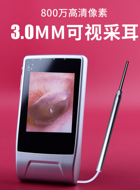 3.0MM精细探头可视挖耳勺内窥镜
