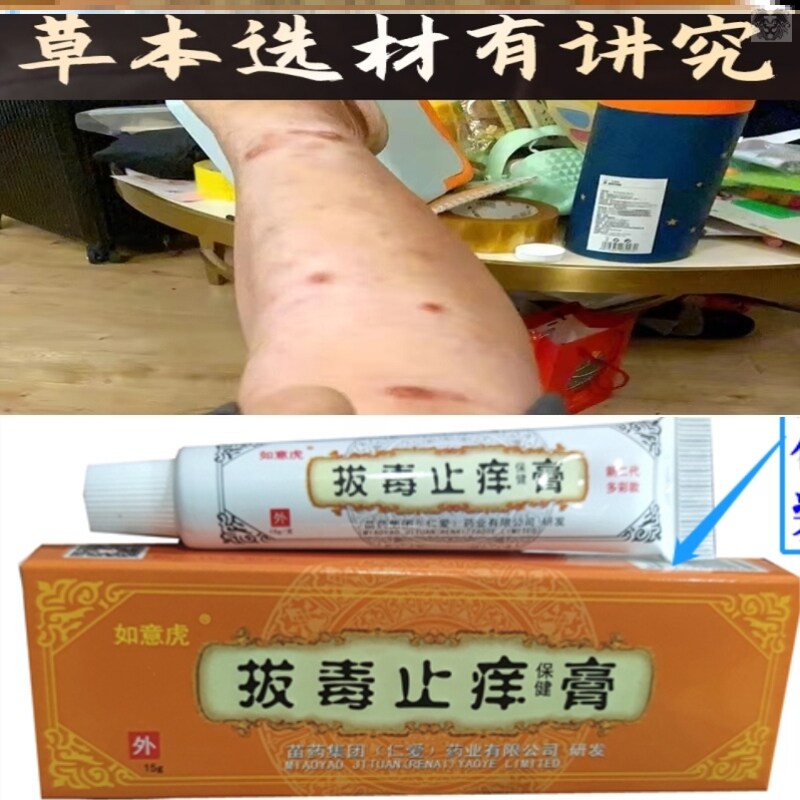如意虎拔毒止痒膏15g买2送1抑菌膏大腿内侧皮肤外用乳膏5送5同款