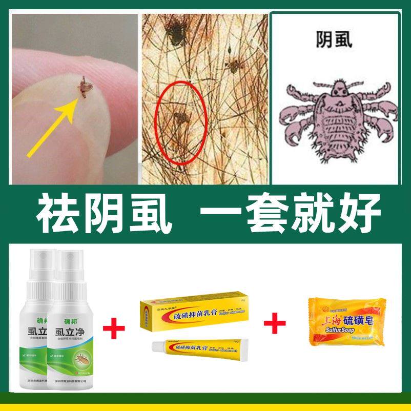 百部酊去阴虱男士用私处止痒药膏女士孕妇老人瘙痒灭阴虱灵卵成人