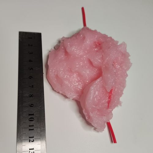 肿物训练模块模型