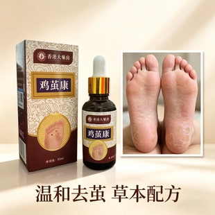 手足王手足鸡茧手足厚茧硬皮手足身体脚趾关节茧脚垫手足膏外用