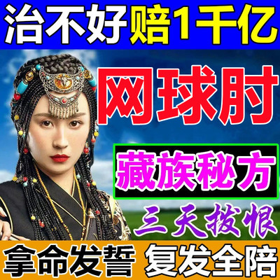 网球肘克星专用药治疗胳膊手肘关节疼痛酸网球肘炎特效药贴膏神器