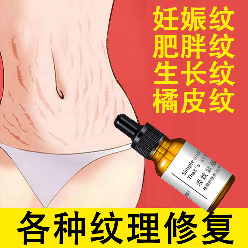 妊辰纹修复霜去肥胖纹学生大腿生长纹屁股孕妇精油女产后肚皮松垮