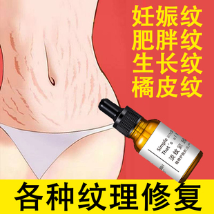 妊辰纹修复霜去肥胖纹学生大腿生长纹屁股孕妇精油女产后肚皮松垮