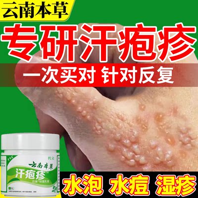 【云南本草】汗疱疹水痘止痒专用