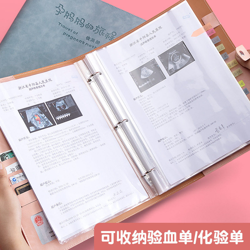 소  임신 테스트 수납장 귀여운 B-초음파 산전 검진 보고서 시트 임산부 검진 시트 A4A5 ??임신 파일장