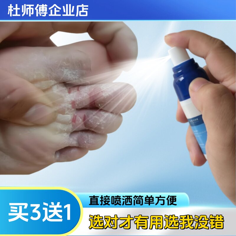 喷剂去角质脱皮干燥草本喷雾剂温和舒适外用特惠买3送1