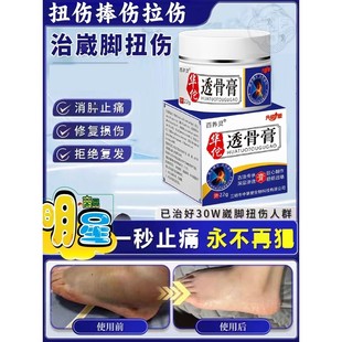 脚踝受伤崴脚走路神器扭伤脚踝热敷脚腕疼痛韧带拉伤恢覆专用药膏