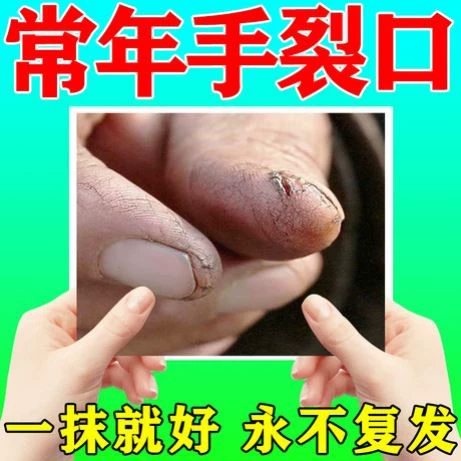 Демисезонный крем для ногтей для пальцев на ноге против сухости, против трещин