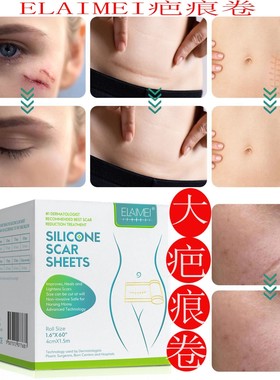 ELAIMEI疤痕卷大尺寸自粘性疤痕祛除贴控增生妊娠纹剖腹产手术贴1