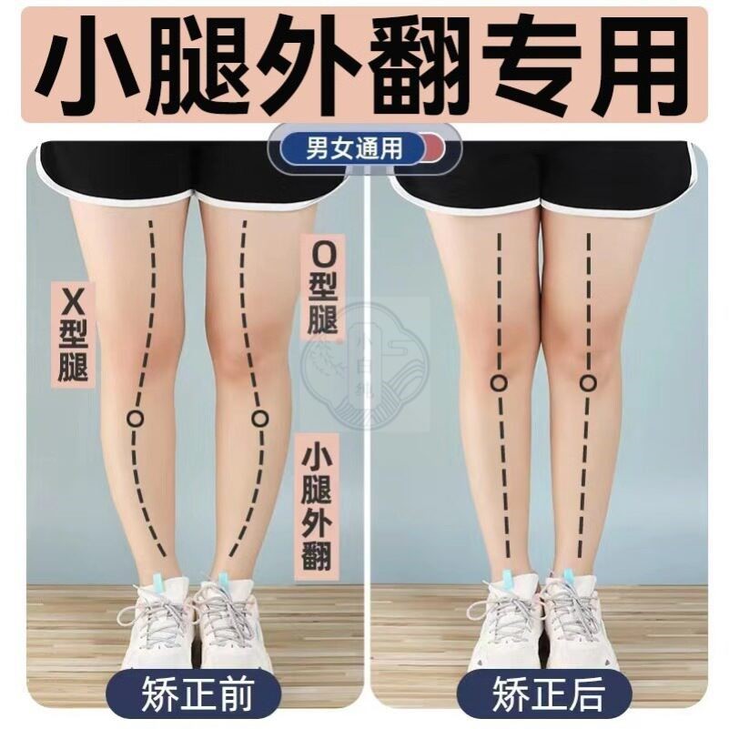 日本O型X型小腿外翻足弓鞋垫矫正腿型女直腿扁平足足弓支撑鞋垫