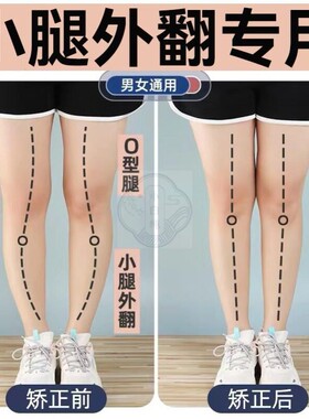 日本O型X型小腿外翻足弓鞋垫矫正腿型女直腿扁平足足弓支撑鞋垫