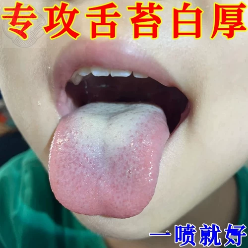 Белое и толстое языковое покрытие, селезенка и желудок для повышения сырости, удаления горечи, запаха, сухого рта, более низкого огня печени, трещин языка, метков зубов, кондиционирования специального лекарства