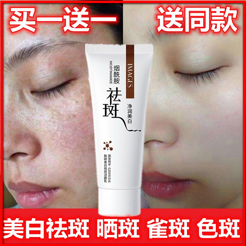 爆款肤妍美白祛斑洗面奶淡斑提亮肤色洁面乳官方旗舰店正品官网