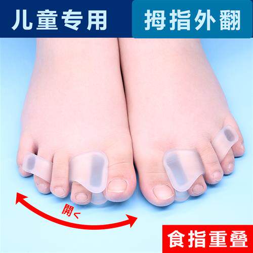 儿童脚趾矫正器 婴儿宝宝脚趾头矫正器二脚趾食指弯曲重叠脚趾