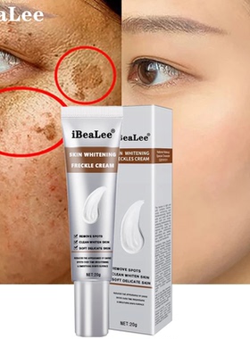 Whitening Freckle Cream Remove Melasma Cream Remove Dark Spo