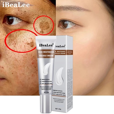 WhiteningFreckleCream