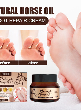 HeelsCrackFootCreamSkin