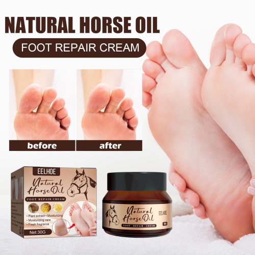 HeelsCrackFootCreamSkin