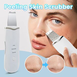 Ultrasonic Peeling Machine Skin Care Blackhead Remover Devic
